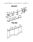 Ultrasound treatment system diagram and image