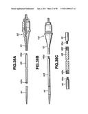 Ultrasound treatment system diagram and image