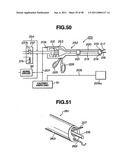 Ultrasound treatment system diagram and image