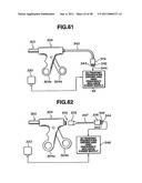 Ultrasound treatment system diagram and image