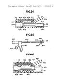 Ultrasound treatment system diagram and image