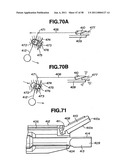 Ultrasound treatment system diagram and image