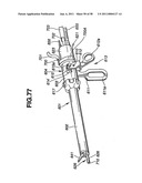 Ultrasound treatment system diagram and image