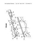 Ultrasound treatment system diagram and image