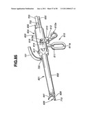 Ultrasound treatment system diagram and image