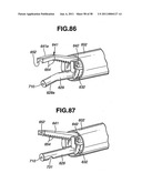 Ultrasound treatment system diagram and image