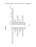 Systems and Methods for Treating Obesity and Type 2 Diabetes diagram and image