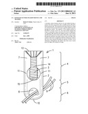 KNOTLESS SUTURE FIXATION DEVICE AND METHOD diagram and image