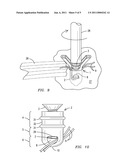 KNOTLESS SUTURE FIXATION DEVICE AND METHOD diagram and image