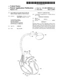 DATA-DRIVEN PATTERN DETECTION OF IMPLANTABLE MEDICAL DEVICE DATA diagram and image