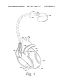 DATA-DRIVEN PATTERN DETECTION OF IMPLANTABLE MEDICAL DEVICE DATA diagram and image