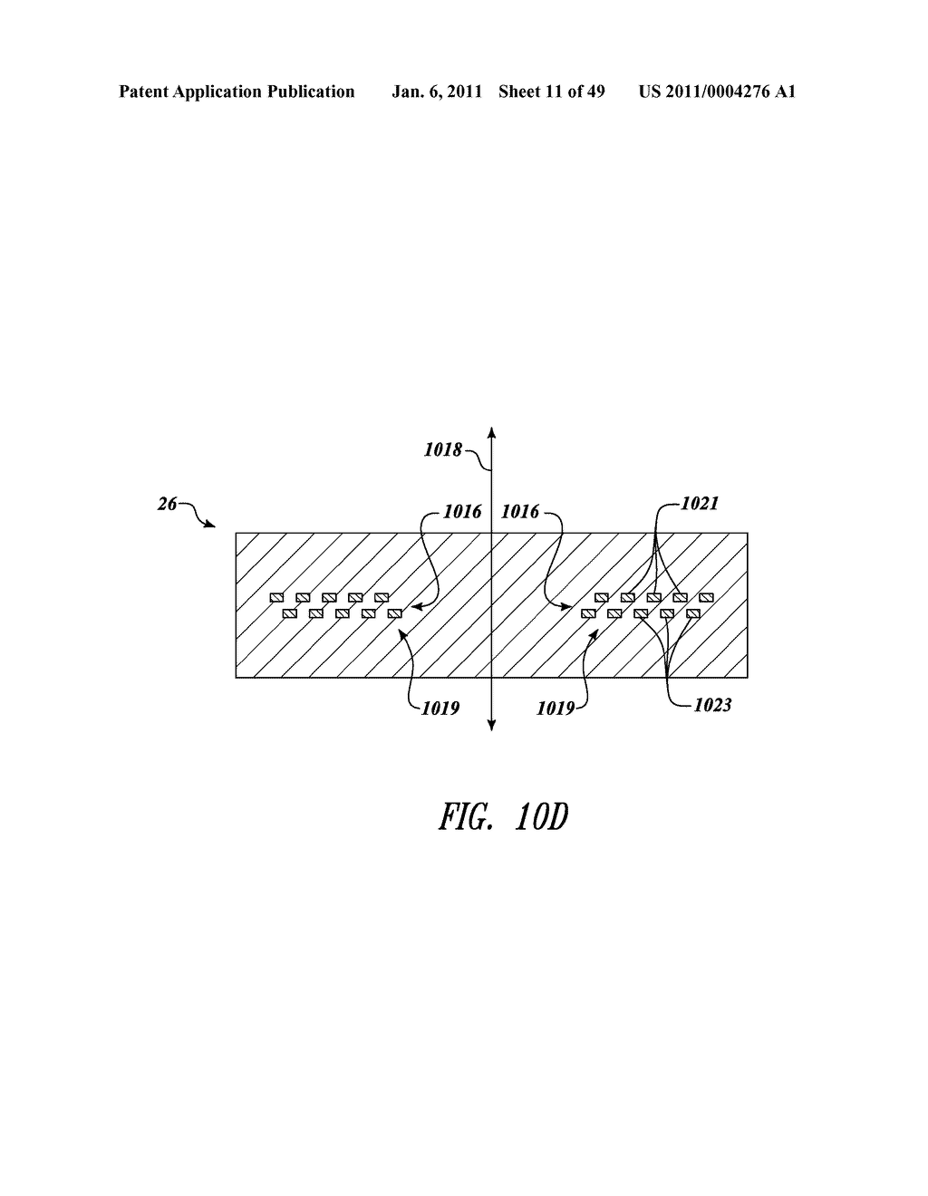 METHOD AND APPARATUS TO DETECT TRANSPONDER TAGGED OBJECTS AND TO COMMUNICATE WITH MEDICAL TELEMETRY DEVICES, FOR EXAMPLE DURING MEDICAL PROCEDURES - diagram, schematic, and image 12