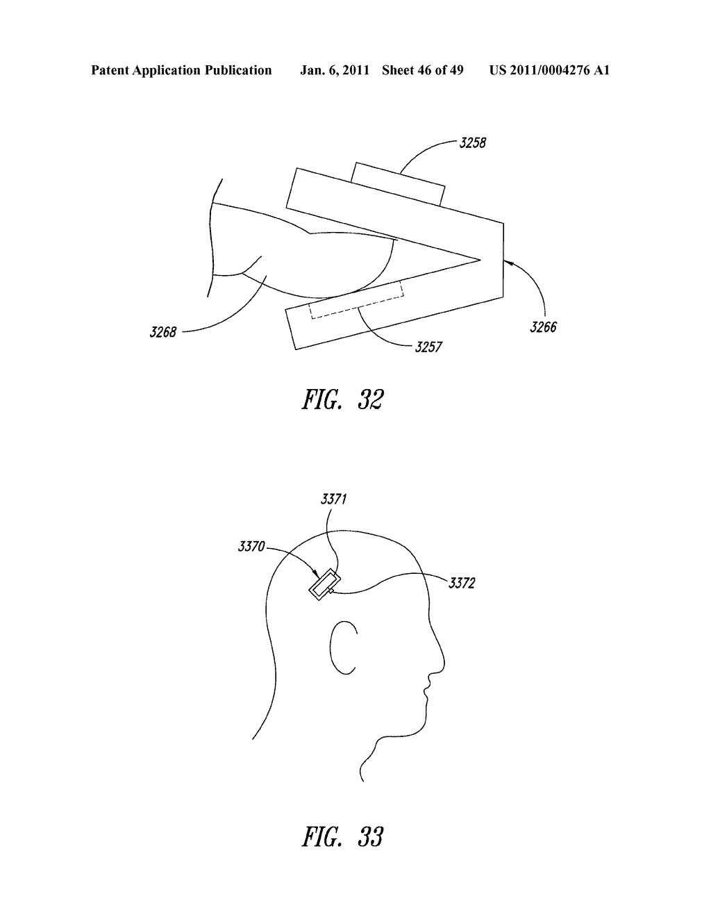 METHOD AND APPARATUS TO DETECT TRANSPONDER TAGGED OBJECTS AND TO COMMUNICATE WITH MEDICAL TELEMETRY DEVICES, FOR EXAMPLE DURING MEDICAL PROCEDURES - diagram, schematic, and image 47