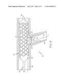 Bifurcated Stent and Delivery System diagram and image