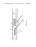 Bifurcated Stent and Delivery System diagram and image