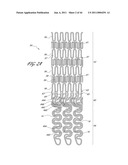 OSTIUM SUPPORT FOR TREATING VASCULAR BIFURCATIONS diagram and image