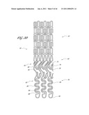 OSTIUM SUPPORT FOR TREATING VASCULAR BIFURCATIONS diagram and image