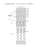 OSTIUM SUPPORT FOR TREATING VASCULAR BIFURCATIONS diagram and image