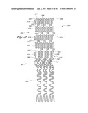 OSTIUM SUPPORT FOR TREATING VASCULAR BIFURCATIONS diagram and image