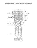 OSTIUM SUPPORT FOR TREATING VASCULAR BIFURCATIONS diagram and image