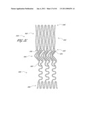 OSTIUM SUPPORT FOR TREATING VASCULAR BIFURCATIONS diagram and image