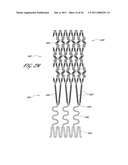 OSTIUM SUPPORT FOR TREATING VASCULAR BIFURCATIONS diagram and image