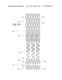 OSTIUM SUPPORT FOR TREATING VASCULAR BIFURCATIONS diagram and image