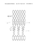 OSTIUM SUPPORT FOR TREATING VASCULAR BIFURCATIONS diagram and image