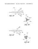 OSTIUM SUPPORT FOR TREATING VASCULAR BIFURCATIONS diagram and image