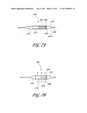 OSTIUM SUPPORT FOR TREATING VASCULAR BIFURCATIONS diagram and image