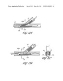 OSTIUM SUPPORT FOR TREATING VASCULAR BIFURCATIONS diagram and image