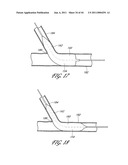 OSTIUM SUPPORT FOR TREATING VASCULAR BIFURCATIONS diagram and image