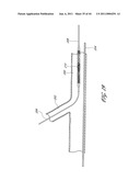 OSTIUM SUPPORT FOR TREATING VASCULAR BIFURCATIONS diagram and image