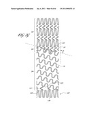 OSTIUM SUPPORT FOR TREATING VASCULAR BIFURCATIONS diagram and image