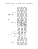 OSTIUM SUPPORT FOR TREATING VASCULAR BIFURCATIONS diagram and image