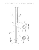 OSTIUM SUPPORT FOR TREATING VASCULAR BIFURCATIONS diagram and image