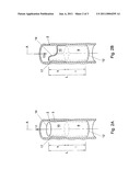 Implant valve for implantation in a blood vessel diagram and image