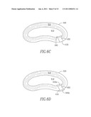 SHAPED IMPLANTS FOR TISSUE REPAIR diagram and image