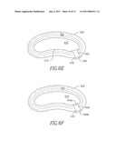 SHAPED IMPLANTS FOR TISSUE REPAIR diagram and image