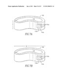 SHAPED IMPLANTS FOR TISSUE REPAIR diagram and image