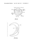 SHAPED IMPLANTS FOR TISSUE REPAIR diagram and image