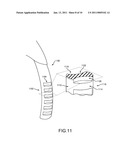 Article of Footwear with Thong Portion Including Grooves diagram and image