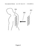 Apparatus and method for engaging acoustic vibration sensors to skin diagram and image