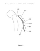 Apparatus and method for engaging acoustic vibration sensors to skin diagram and image