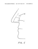 QUIET NASAL RESPIRATORY DEVICES diagram and image