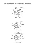 QUIET NASAL RESPIRATORY DEVICES diagram and image