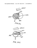 QUIET NASAL RESPIRATORY DEVICES diagram and image