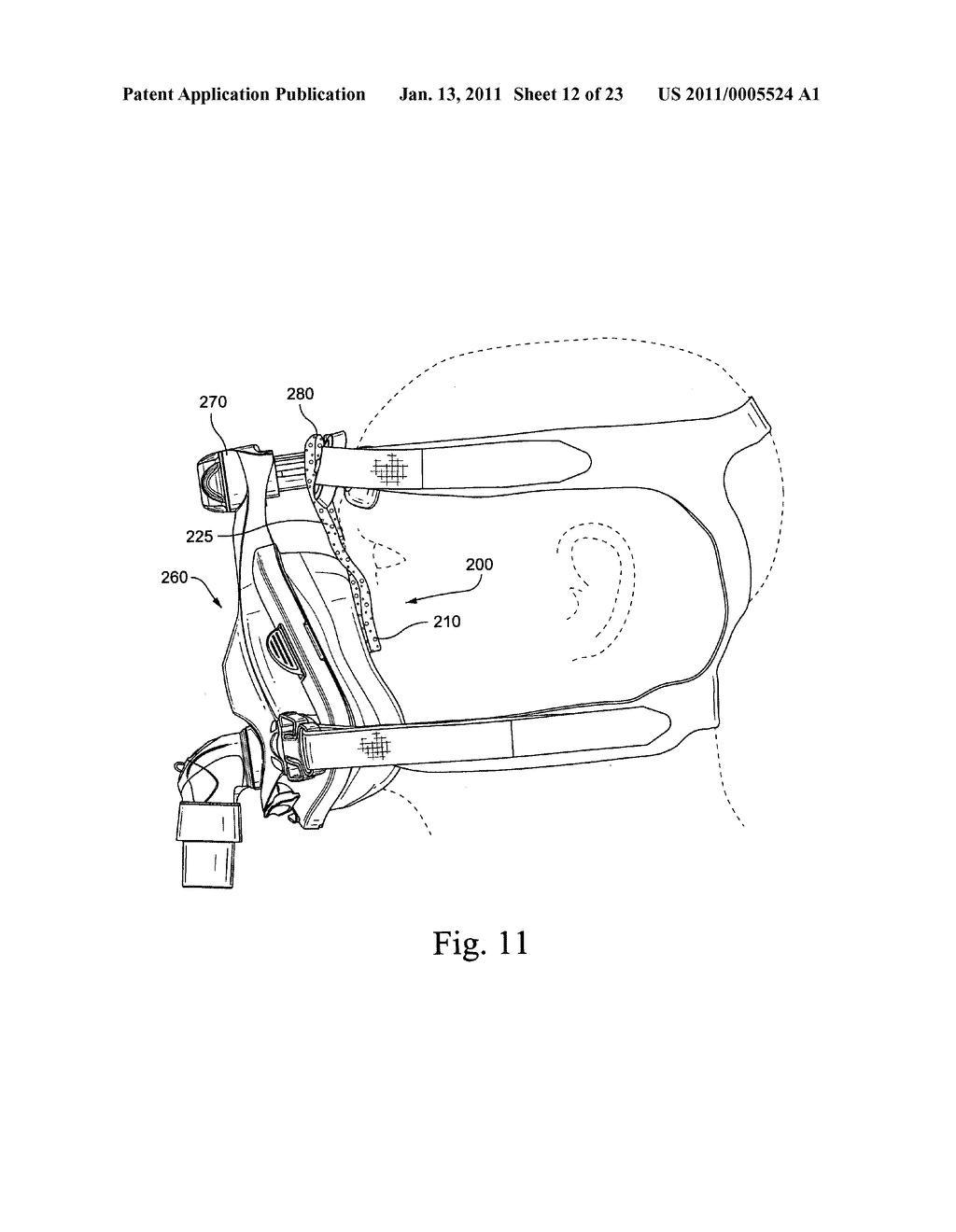 Pad for a mask - diagram, schematic, and image 13