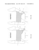 METHOD AND APPARATUS FOR THERAPEUTICALLY SUPPORTING THE ARM OF A PATIENT diagram and image