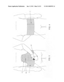 METHOD AND APPARATUS FOR THERAPEUTICALLY SUPPORTING THE ARM OF A PATIENT diagram and image